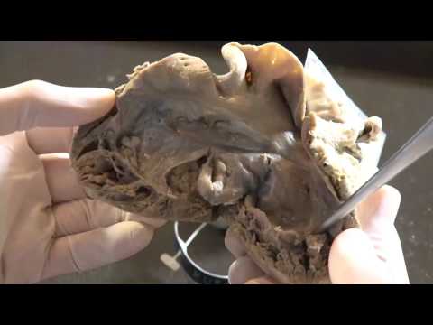 Heart Specimen Observation - Corrected TGA