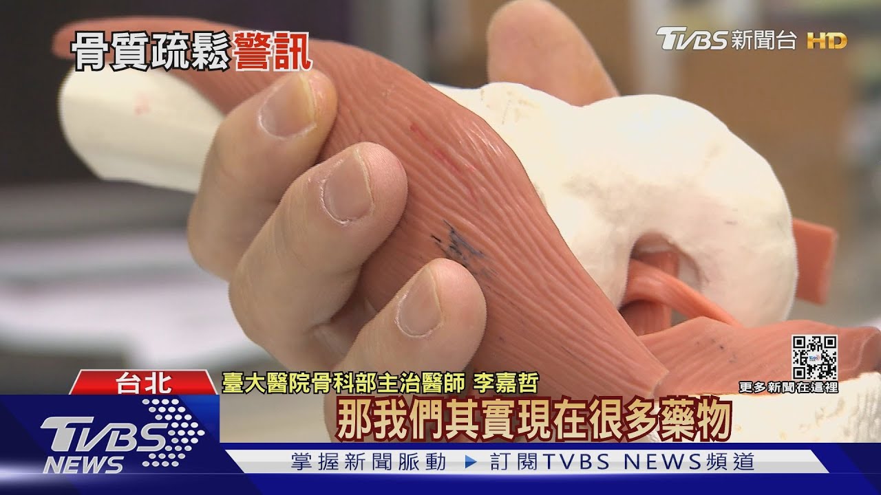 「這族群」每4人當中 就有1人骨鬆身體缺乏「它」恐失能!