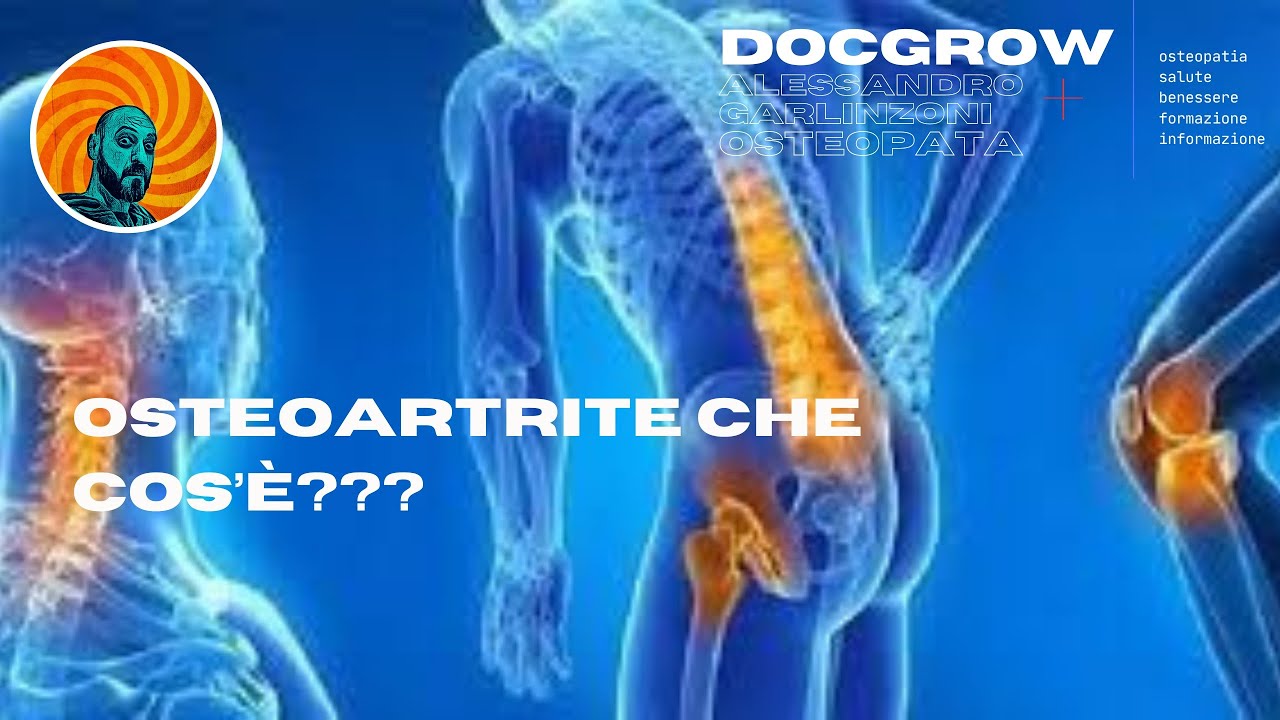 Alessandro Garlinzoni-7