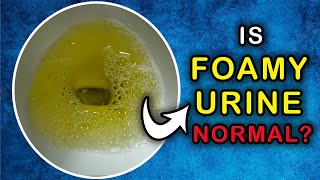 Is it NORMAL to have a FOAMY URINE: Cause and Treatment