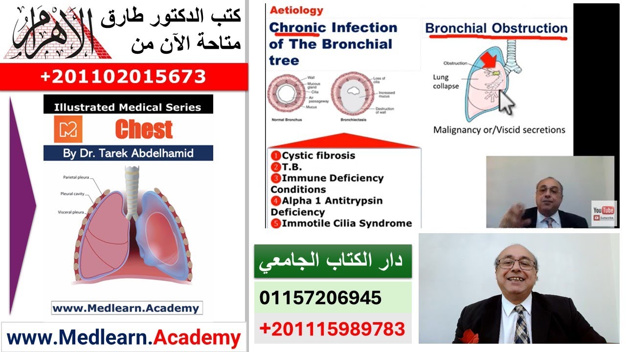 Bronchiectasis   #cme #internal_medicine #medical #usmle #محاضرات_باطنة