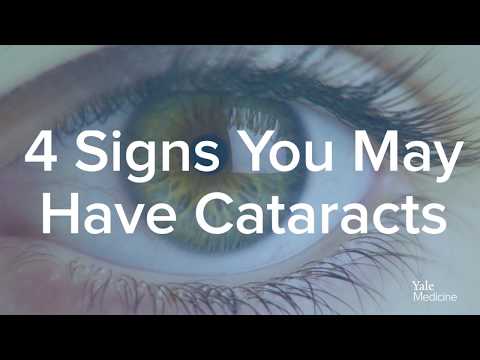 #FourThings About Developing Cataracts