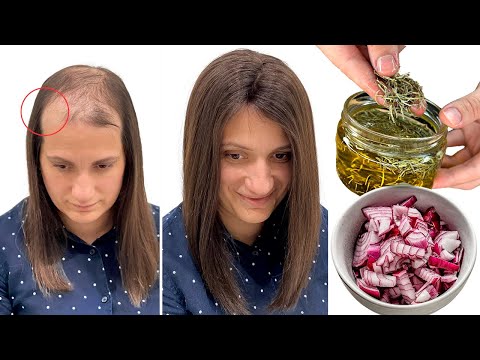 Your hair will grow like crazy in just a few days and won't fall out. Pure gold for your hair.