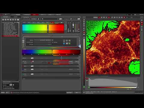 Leica SP8 STED 3X: 2D STED example