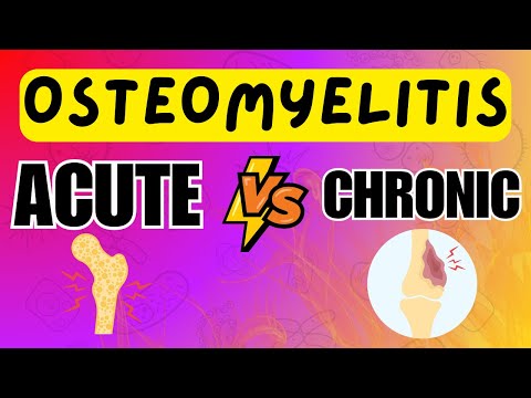 image-Can osteomyelitis lead to amputation?