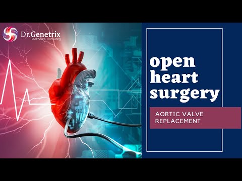 Aortic Valve Replacement Surgery | Open Heart Surgery ❤️