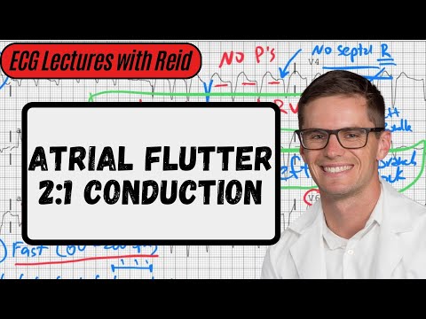 2:1 Atrial Flutter | Day 12 ECG Challenge