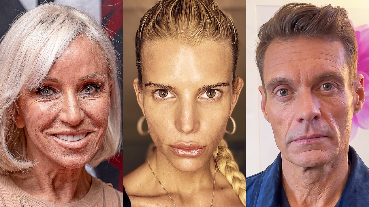 Hollywood Has a New 'Ozempic Face'… And It's TERRIFYING