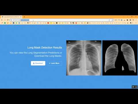 U NET Lung Cancer in Python Projects