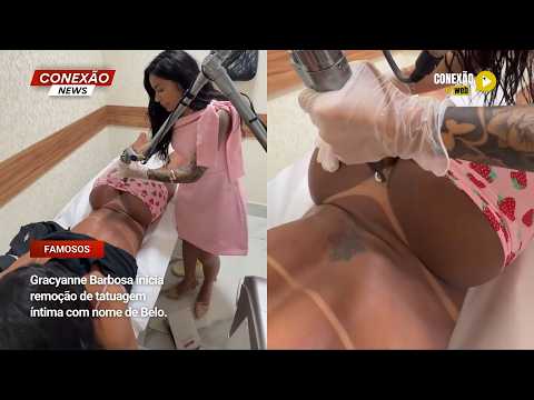 Vídeo: Gracyanne Barbosa inicia remoção de tatuagem íntima com nome de Belo.