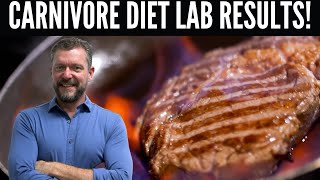 Carnivore Diet will do this to Your Labs [Carnivore Diet Results]- 2024