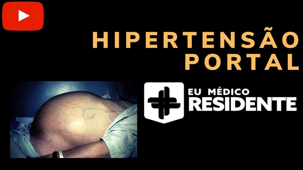 Hipertensão Portal para Residência Médica