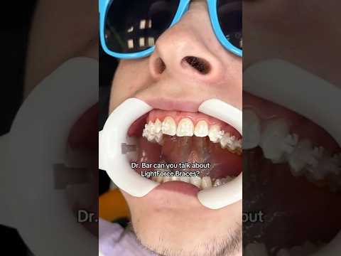 What are LightForce Braces?