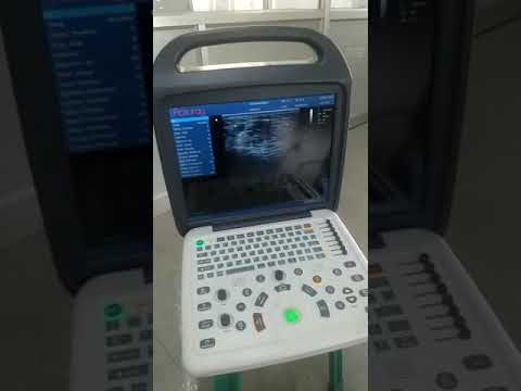 Portable Color Doppler Ultrasound Scanner