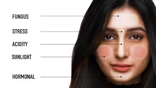What Your Pimples Say About Your Health | Face Mapping with Dermatologist Bindu Sthalekar