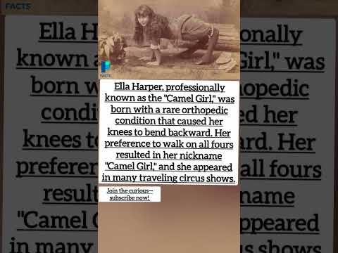 The Incredible Story of Ella Harper, the "Camel Girl" #shorts
