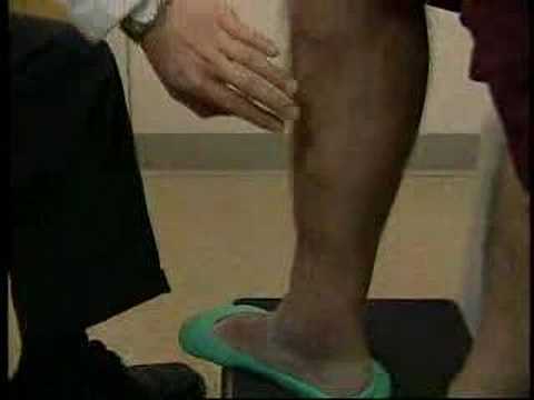 Laser Treatment For Varicose Vein Treatment