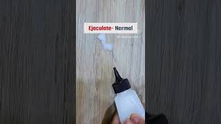 warning signs of male ♂️ discharge!! 2023