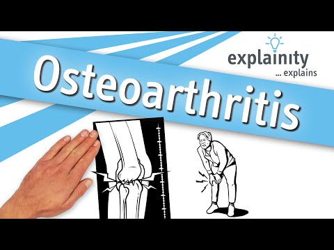 Osteoarthritis – explained simply