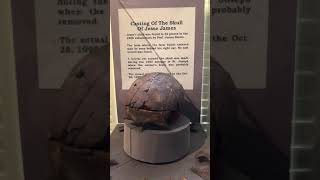 Jesse James’ skull