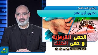 الحمى القرمزية و حمى الضنك الطب الأمن دكتور أمير صالح