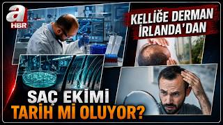 SAÇI YÜZDE 539 ORANINDA ÇOĞALTTI! Saç Ekimi Tarih Mi Oluyor? | A Haber