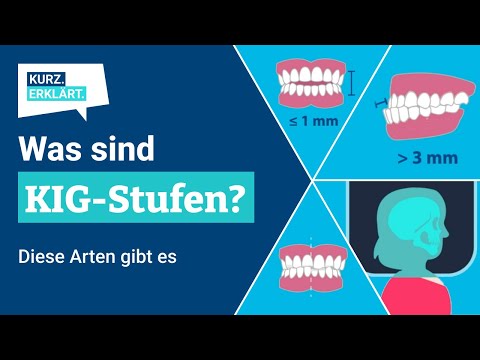 KIG-Stufen: Was bedeuten die kieferorthopädischen Indikationsgruppen?