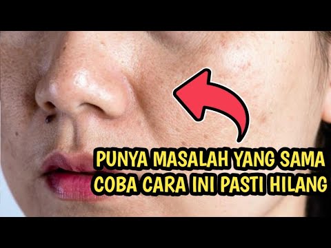 CARA MENCERAHKAN WAJAH KUSAM & MENGHILANGKAN PORI-PORI BESAR [tanpa biaya Mahal] Tips Kecantikan