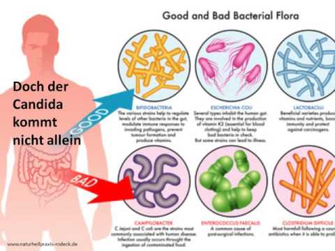 Die Behandlung von der Volksmedizin gribka auf den Nägeln der Beine Gribok der Nägel auf den Händen die Behandlung die Klinik