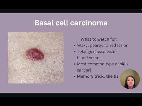 NP Exam Prep: Basics of Skin Cancer Review 👩‍⚕️