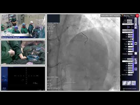 PCI Of The Calcified CTO