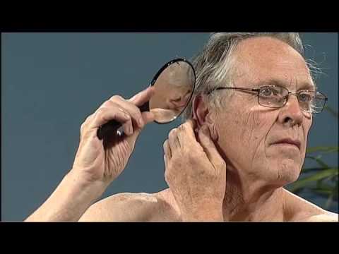 Self skin examination video. About melanoma