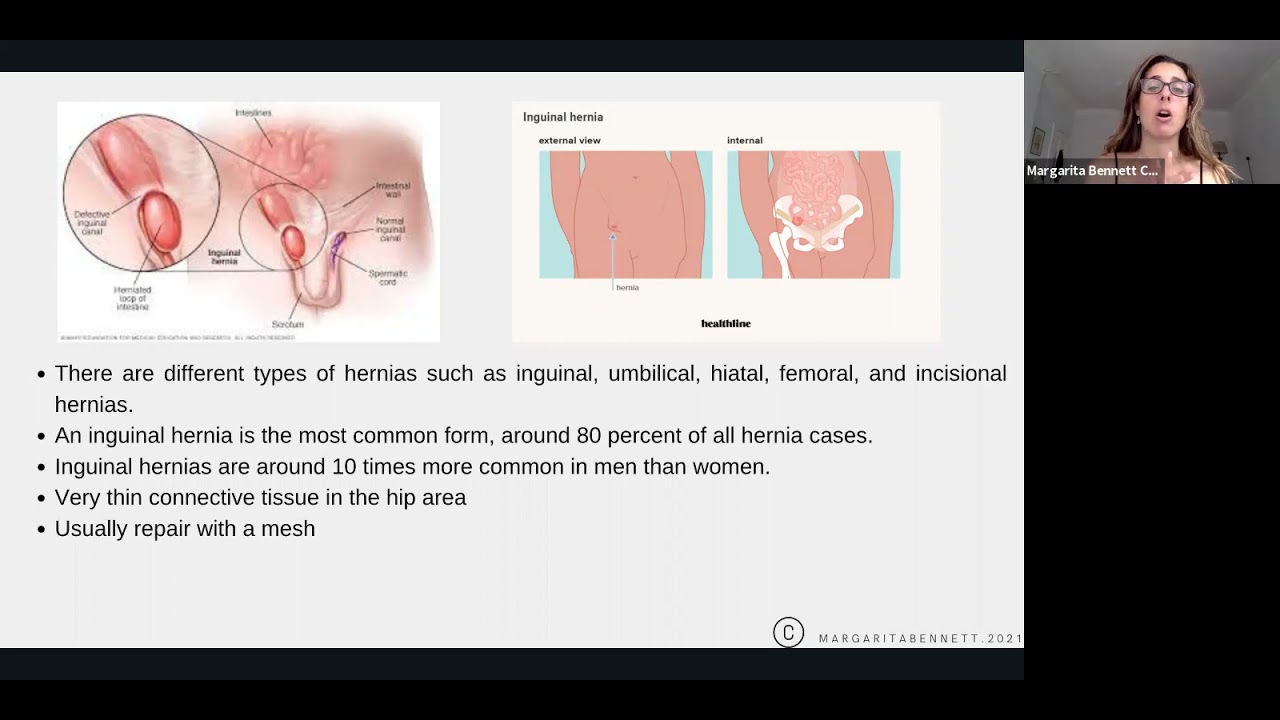 Anatomy, Hernias and MFR