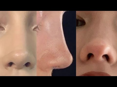 Experimental daint𝓎 pixi3 no𝒮e ♡ ⋆ [1X MAX]