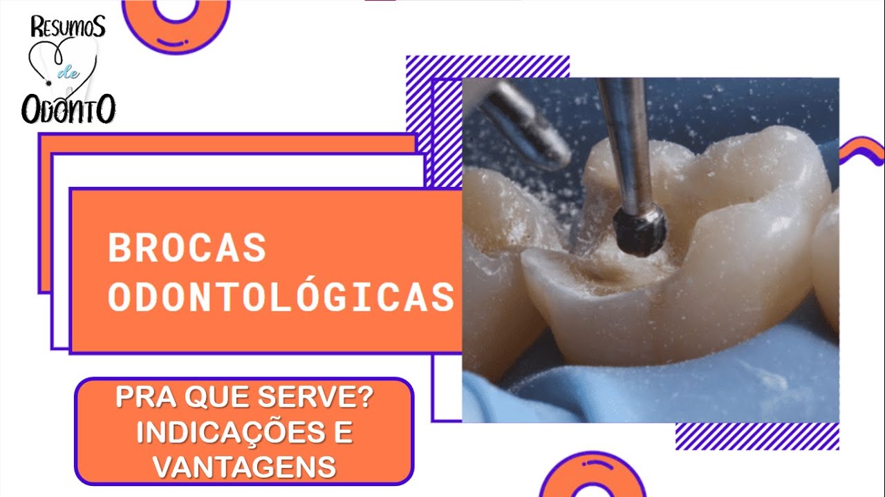 Brocas Odontológicas: Tipos e Usos