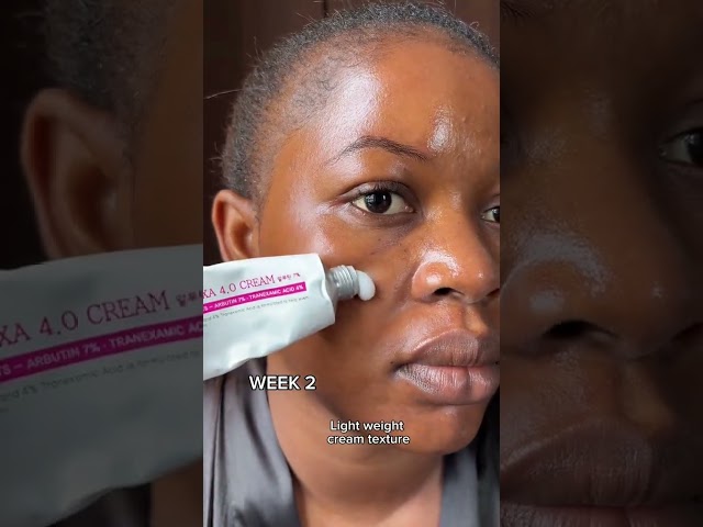 Vídeo relacionado con Lightenup, Skin Lightening Gel | 1 Fl oz 30g | Whitening Cream, Hyperpigmentation Treatment | Fade Dark Spots on: Underarm, Armpit, Face, Body, Intimate Area, with Tamarind & Alpha Arbutin