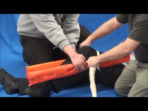 Splinting a Bent Knee
