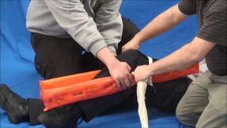 Splinting a Bent Knee