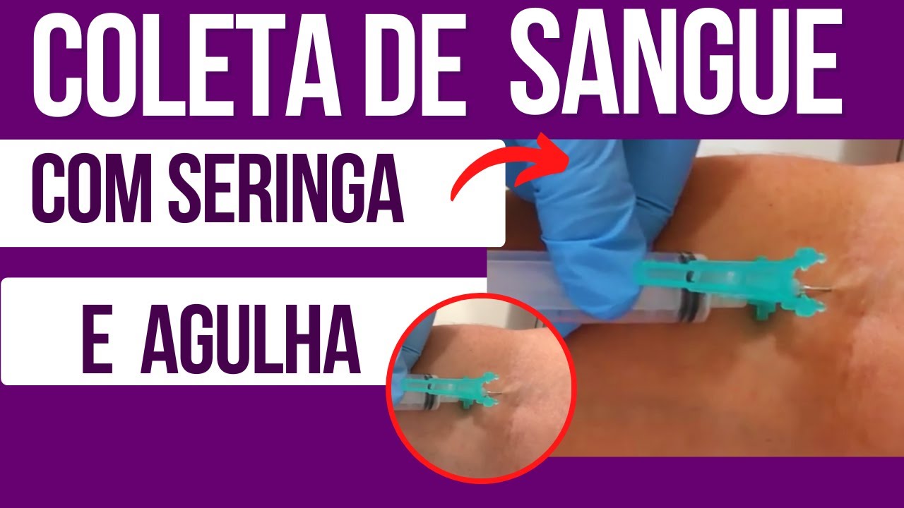 Coletando Sangue Venoso Periférico com Seringa e Agulha #puncaovenosa #nasctreinamentosenfermagem