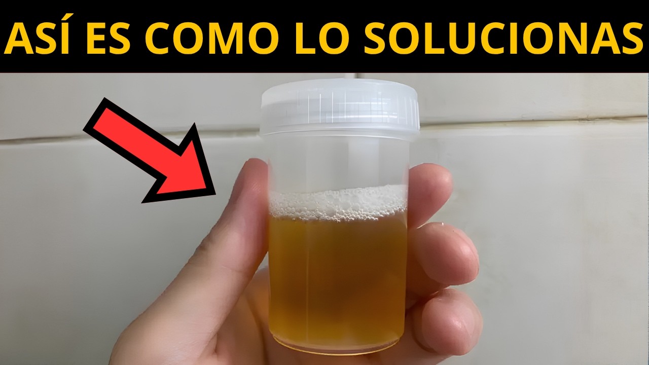 ELIMINA LA PROTEINURIA (proteinas en la orina) con estos CONSEJOS