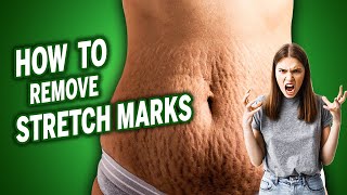 How to Have a Natural Skincare Routine | Part 2