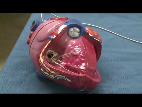 Wenn das Herz Hilfe braucht: Der Herzschrittmacher erklärt | MÄNZ ERKLÄRT