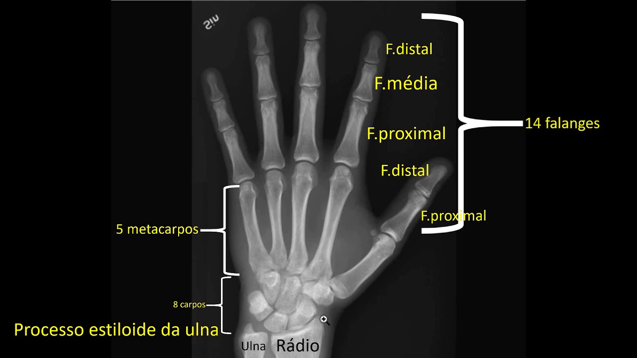 Radiologia - Anatomia radiográfica da mão e punho