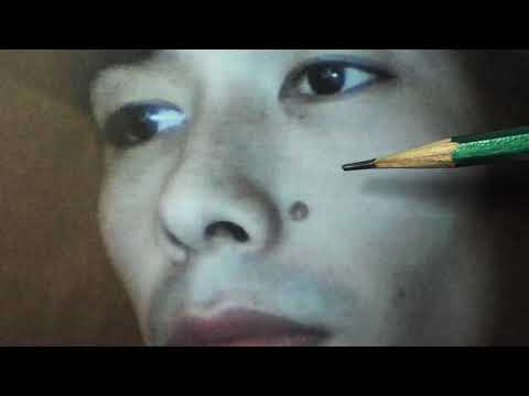 鼻子旁有痣