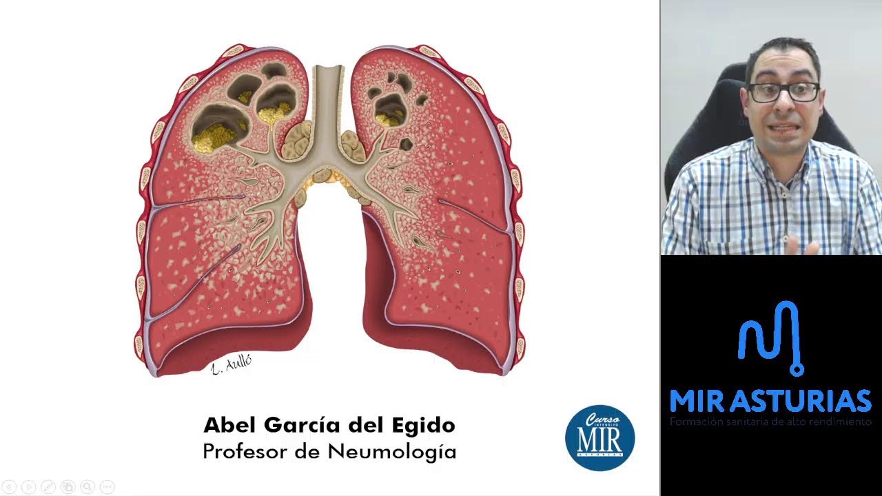 TALLER NEUMOLOGÍA MAYO 2024