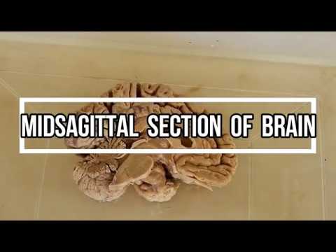 Midsagittal Section of Brain / neuroanatomy