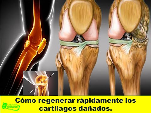 Dolor de cuello y el hombro de la posición incómoda La osteoartritis es la osteocondrosis