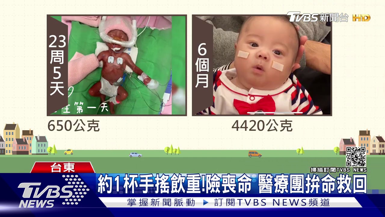 可以回家了!最小洗腎嬰 治療半年終出院