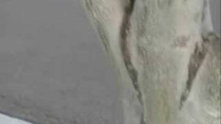 EPHEDRINE COMMERCIAL