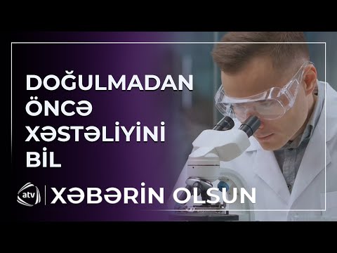 Genetik test - doğulmadan öncə xəstəliyini bil